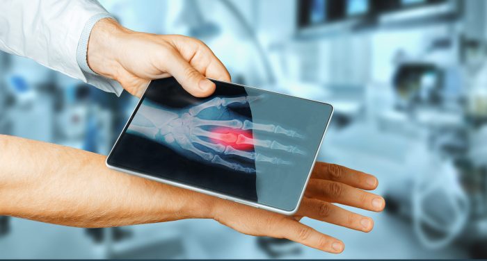 Medical devices innovative device innovation medicare question real research used obamacare legacymedsearch